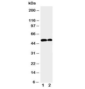 Western blot testing of NOXA1 antibody and Lane 1: U87; 2: HeLa cell lysate. Predicted/observed size: ~51KD
