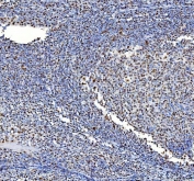 IHC staining of FFPE human tonsil tissue with Nucleophosmin antibody. HIER: boil tissue sections in pH8 EDTA for 20 min and allow to cool before testing.