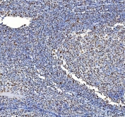 ICC testing of Nucleophosmin antibody and HeLa cells