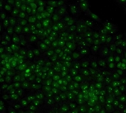 Immunofluorescent staining of FFPE human A431 cells with Nucleophosmin antibody. HIER: steam section in pH6 citrate buffer for 20 min.