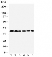 Western blot testing of Nucleophosmin antibody and Lane 1:  rat testis;  2: rat brain;  3: human HeLa;  4: human U87 MG;  5: human A549;  6: human SMMC-7721 cell lysate.  Expected molecular weight: ~38 kDa.