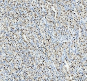 Western blot testing of Nucleophosmin antibody and Lane 1:  rat testis;  2: rat brain;  3: human HeLa;  4: human U87 MG;  5: human A549;  6: human SMMC-7721 cell lysate.  Expected molecular weight: ~38 kDa.