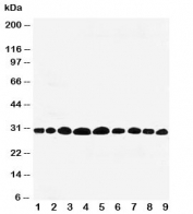 Western blot testing of Prohibitin antibody and rat samples 1: lung;  2: skeletal muscle;  3: brain;  4: kidney; and 5: human HeLa;  6: (h) MCF-7;  7: (r) PC-12;  8: (h) A549;  9: (h) SMMC-7721 cell lysate.  Expected/observed size ~30KD