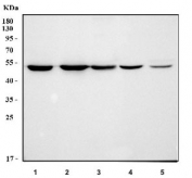 Western blot testing of 1) human HeLa, 2) human 293T, 3) human SK-O-V3, 4) mouse testis and 5) mouse NIH 3T3 cell lysate with HIP antibody. Expected molecular weight: ~48 kDa.