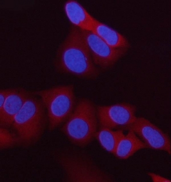 Immunofluorescent staining of FFPE human HeLa cells with HIP antibody (red) and DAPI nuclear stain (blue). HIER: steam section in pH6 citrate buffer for 20 min.~