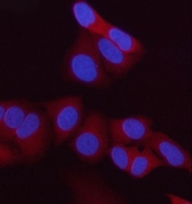 Immunofluorescent staining of FFPE human HeLa cells with HIP antibody (red) and DAPI nuclear stain (blue). HIER: steam section in pH6 citrate buffer for 20 min.