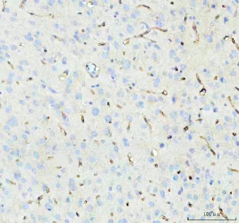 IHC-P: Aquaporin 4 antibody testing of rat brain tissue. HIER: steamed with pH6 citrate buffer.