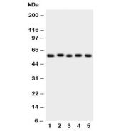 Western blot testing of ASIC3 antibody and Lane 1:  rat brain;  2: (r) testis;  3: human U87;  4: mouse Neuro-2a;  5: (h) SMMC-7721 cell lysate.  Expected/observed molecular weight: ~59 kDa.