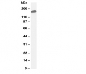 Western blot testing of GLI2 antibody and human placenta tissue lysate.  Expected/observed size ~168KD