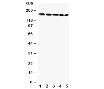 Western blot testing of GLI2 antibody and Lane 1: MCF-7; 2: HeLa; 3: SKOV; 4: HT1080; 5: A549 cell lysate. Predicted molecular weight: 86~168 kDa (multiple isoforms)(1).~