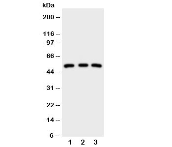 Western blot testing of IRAK antibody; Lane 1: HeLa; 2: U87; 3: MCF-7 cell lysate. Expected/observed size ~52KD