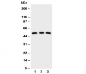 Western blot testing of IRAK antibody;  Lane 1: HeLa;  2: U87;  3: MCF-7 cell lysate.  Expected/observed size ~52KD