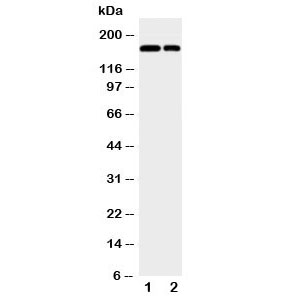Western blot testing of CD11b antibody and Lane 1: Jurkat; 2: Raji; Observed size: 127~170KD due to glycosylation