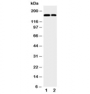 Western blot testing of CD11b antibody and Lane 1: Jurkat;  2: Raji;  Observed molecular weight: 127~170 kDa due to glycosylation.