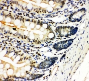IHC-P: NFKB2 antibody testing of rat intestine tissue