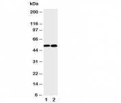 Western blot testing of NFKB2 antibody and Lane 1: mouse liver;  2: (m) HEPA cell lysate.  Expected size 52 or 100KD, depending on sample tested