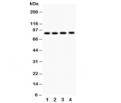 Western blot testing of NOX5 antibody and  Lane 1: 22RV1;  2: PANC;  3: HeLa;  4: SKOV.  Expected/observed molecular weight: ~86 kDa.