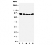 Western blot testing of OSBP antibody and Lane 1:  rat kidney;  2: (r) spleen;  3: (r) lung;  4: human HeLa;  5: (h) A549 cell lysate
