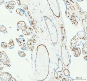 IHC staining of FFPE human placental tissue with CD31 antibody. HIER: boil tissue sections in pH8 EDTA for 20 min and allow to cool before testing.