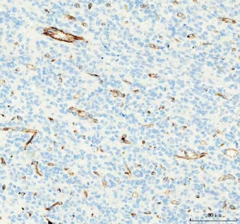 IHC staining of frozen human placental tissue with CD31 antibody.