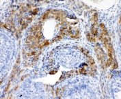 IHC staining of FFPE rat ovary with CYPOR antibody. HIER: boil tissue sections in pH6, 10mM citrate buffer, for 20 min and allow to cool before testing.