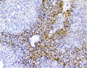 IHC staining of FFPE rat liver with p62 antibody. HIER: boil tissue sections in pH6, 10mM citrate buffer, for 10-20 min and allow to cool before testing.