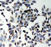 ICC staining of human HeLa cells with p62 antibody.