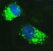 Immunofluorescent staining of FFPE human A549 cells with p62 antibody (green) and DAPI nuclear stain (blue). HIER: steam section in pH6 citrate buffer for 20 min.