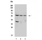 Western blot testing of human 1) HeLa, 2) COLO-320 and 3) A549 lysate with p62 antibody. Expected molecular weight ~62 kDa.