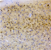 IHC staining of FFPE mouse brain with p62 antibody. HIER: boil tissue sections in pH8 EDTA for 20 min and allow to cool before testing.