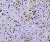 IHC staining of FFPE rat brain with p62 antibody. HIER: boil tissue sections in pH8 EDTA for 20 min and allow to cool before testing.