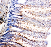 IHC staining of FFPE rat intestine with p62 antibody. HIER: boil tissue sections in pH6, 10mM citrate buffer, for 10-20 min and allow to cool before testing.