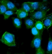 Immunofluorescent staining of FFPE human A431 cells with ZO-2 antibody (green) and DAPI nuclear stain (blue). HIER: steam section in pH6 citrate buffer for 20 min.