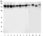 Western blot testing of 1) human RT4, 2) human A431, 3) human HepG2, 4) human HaCaT, 5) human MCF7, 6) human U-2 OS, 7) human HeLa, 8) human PC-3, 9) rat liver, 10) rat RH35, 11) mouse liver and 12) mouse HEPA1-6 cell lysate with ZO-2 antibody.  Expected molecular weight: 131-160 kDa.