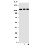 Western blot testing of TLR10 antibody and Lane 1:  HeLa;  2: Jurkat;  3: CEM cell lysate.  Observed size: 95-130KD, depending on glycosylation level