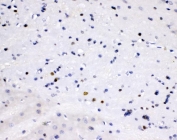 IHC staining of FFPE rat brain tissue with SIP1 antibody. HIER: boil tissue sections in pH6 citrate buffer for 20 min and allow to cool before testing.