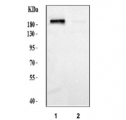 Western blot testing of human 1) HEL and 2) MCF7 cell lysate with SIP1 antibody.  Predicted molecular weight: 120-136 kDa.