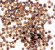 ICC testing of RIAM antibody and Jurkat cells