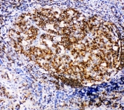 IHC-P: RIAM antibody testing of human tonsil tissue