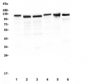 Western blot testing of RIAM antibody and human 1) ThP-1, 2) Jurkat, 3) Raji, 4) U937, 5) rat thymus and 6) mouse thymus lysate.  Predicted molecular weight ~73~110 kDa.
