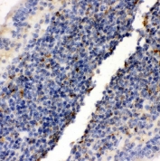 IHC-P: RIAM antibody testing of rat lymph tissue