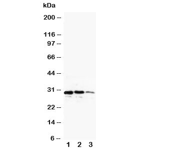 Western blot testing of CUEDC2 antibody and recombinant protein, 29KD with tag; Lane 1: 10ng; 2: 5ng; 3: 2.5ng; 4: 1.25ng~