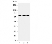 Western blot testing of VASA antibody and Lane 1:  rat testis;  2: mouse testis;  3: (m) ovary tissue lysate
