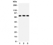 Western blot testing of VASA antibody and Lane 1:  rat testis;  2: mouse testis;  3: HeLa cell lysate