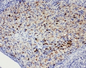 IHC-P: VASA antibody testing of rat ovary tissue