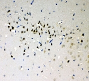 IHC-P: DDX5 antibody testing of rat brain tissue