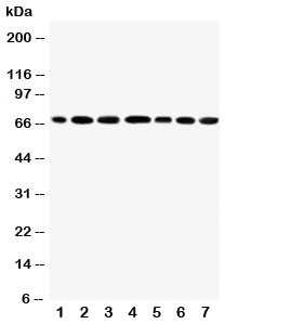 Western blot testing of DDX5 antibody and Lane 1: rat testis; 2: mouse testis; 3: human HeLa; 4: (h) MCF-7; 5: (m) NIH3T3; 6: (h) SKOV; 7: (h) MM231. Predicted/observed size ~68KD~