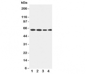 Western blot testing of LCAT antibody and Lane 1:  rat brain;  2: U87;  3: HeLa;  4: SMMC-7721 cell lysate.  Observed size 50~75KD, depending on glycosylation level.