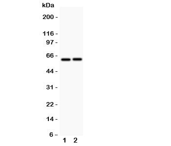 Western blot testing of LTBR antibody and Lane 1: HeLa; 2: A549; Observed size: 45~60KD depending on glycosylation level~