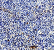IHC staining of FFPE human tonsil tissue with NRG1 antibody. HIER: boil tissue sections in pH8 EDTA for 20 min and allow to cool before testing.